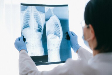 VHV Neue Behandlungsmoeglichkeiten bei Lungenkrebs2025 radionews